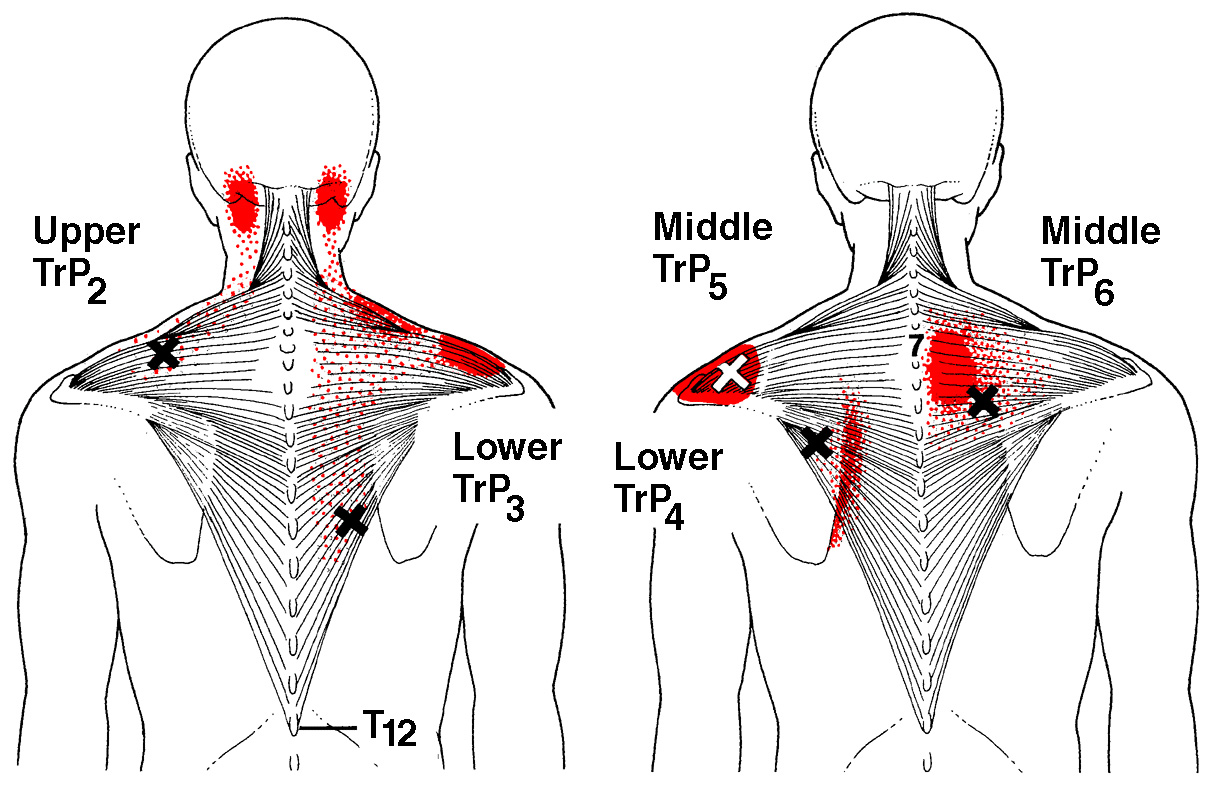 what to do if your back hurts